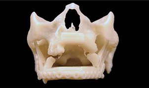 仁心仁術(shù)和3D打印技術(shù)幫助布拉辛馬克維拉重新綻放笑容