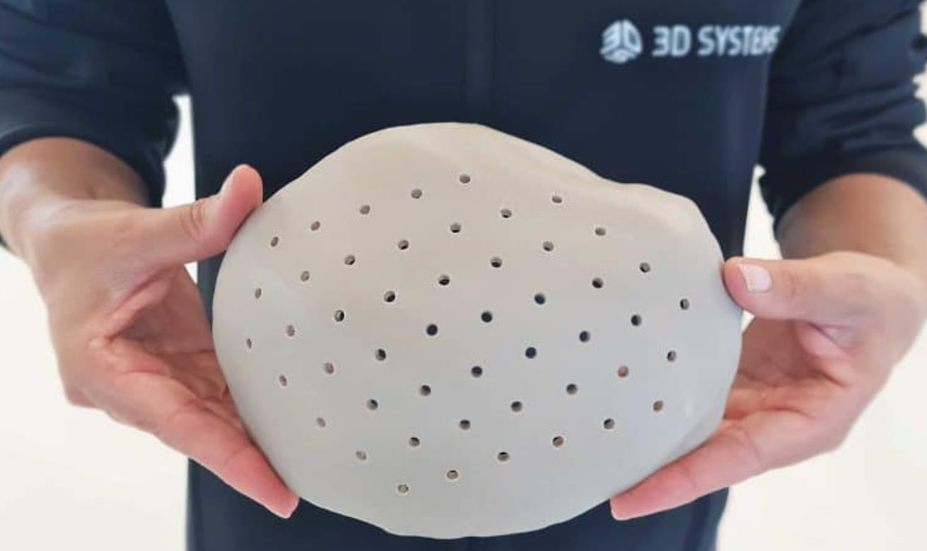 FDA已批準(zhǔn)3D Systems 3D打印患者特定的 VSP PEEK 顱骨植入解決方案